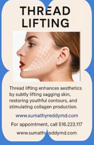 threadlifting